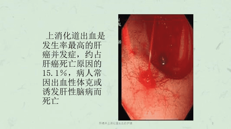 肝癌病人怎么补硒