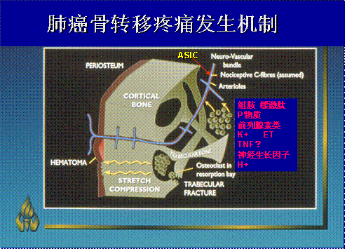 补硒能治愈肺癌吗