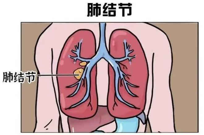 乳房实性结节补硒