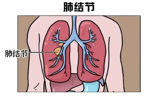 乳房实性结节补硒