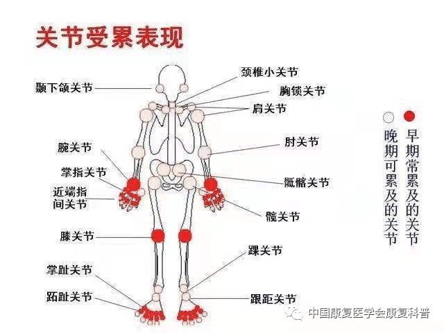 补硒治疗大骨节病