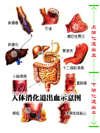 肝病为什么要补硒