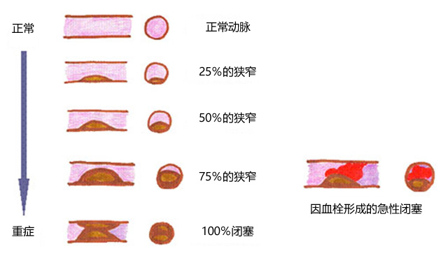 为什么老年要补硒