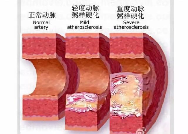 为什么老年要补硒