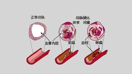 为什么老年要补硒