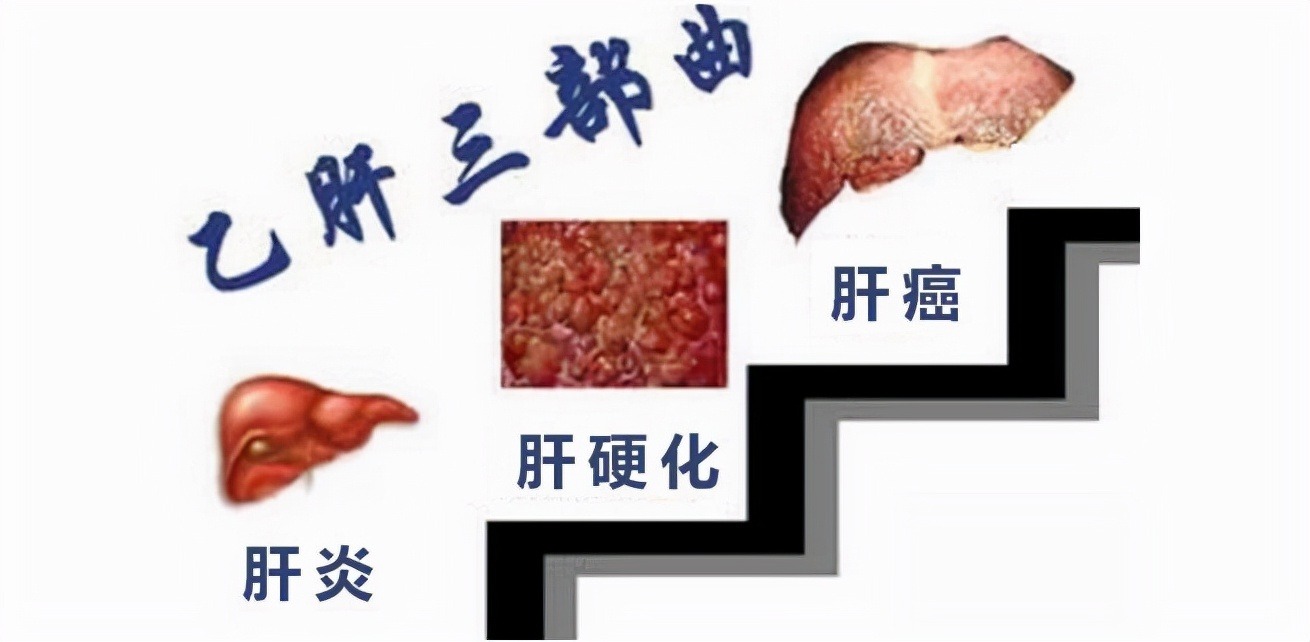 乙肝患者怎么补硒