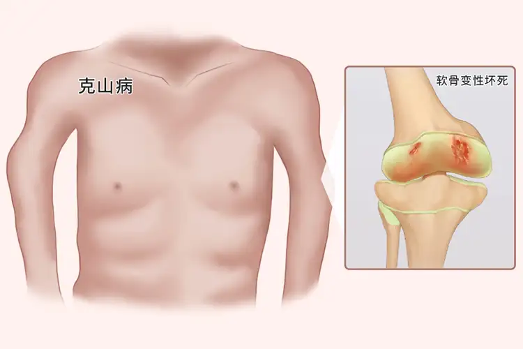 经常补硒可以防癌