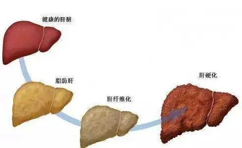 头疼补硒有改善吗