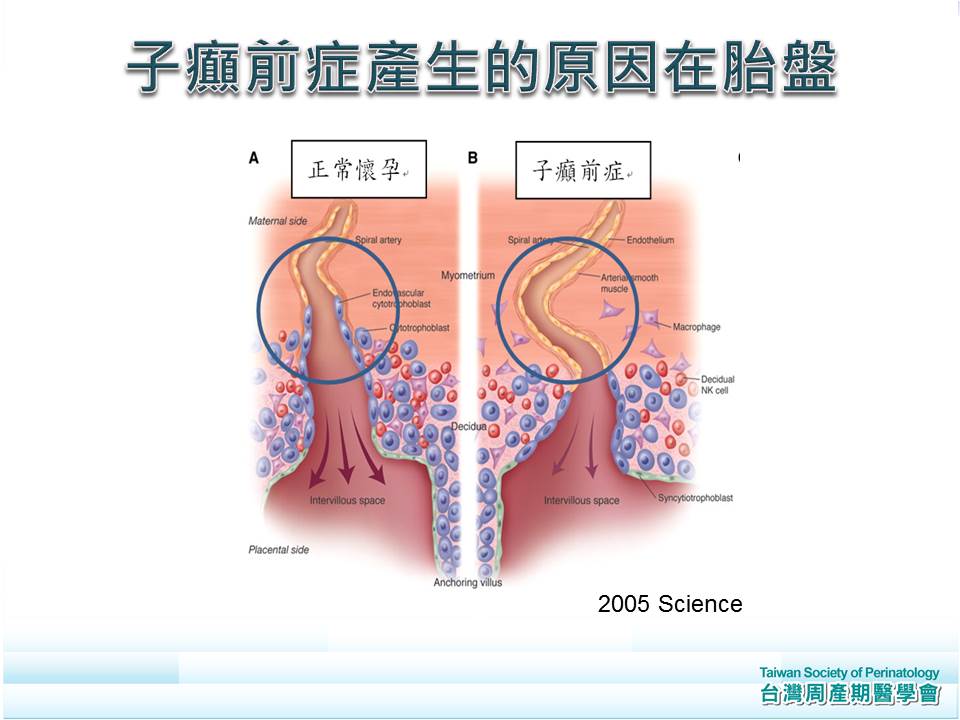 怀孕后可以补硒吗