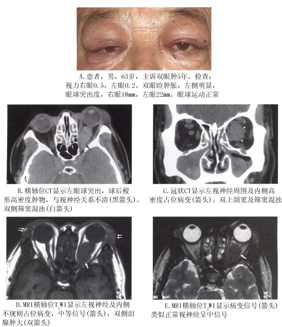 补硒能治疗皮炎吗