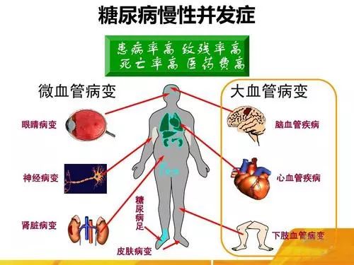 糖尿病需要补硒嘛