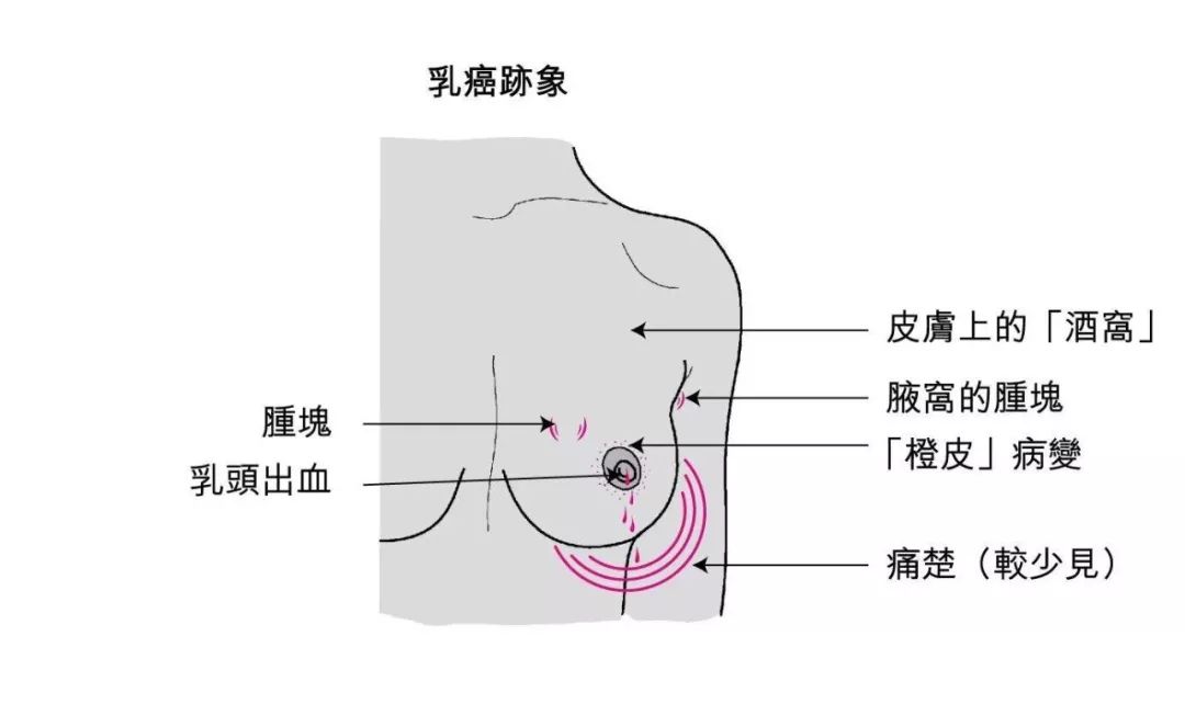 乳腺癌补硒的水果