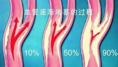 硒与高血脂