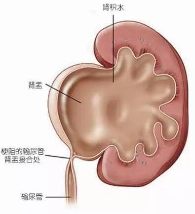 肌酐高可以补硒吗