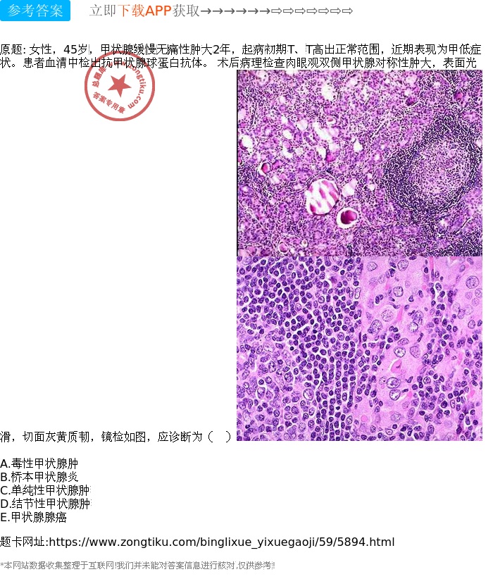 甲亢病补硒有用吗