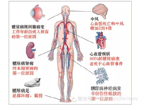 糖尿病人补镉和硒