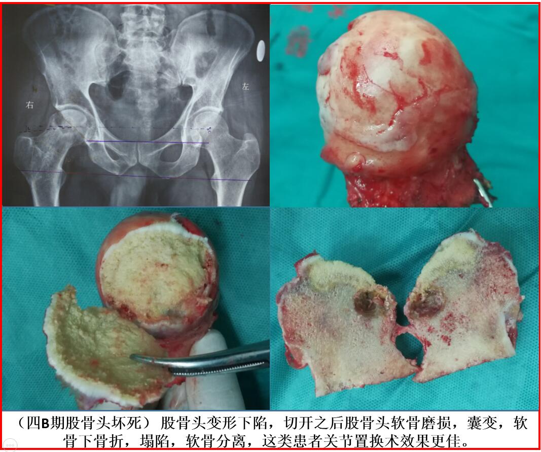 硒产品的销售模式