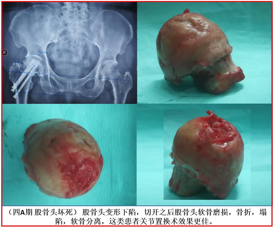 硒产品的销售模式