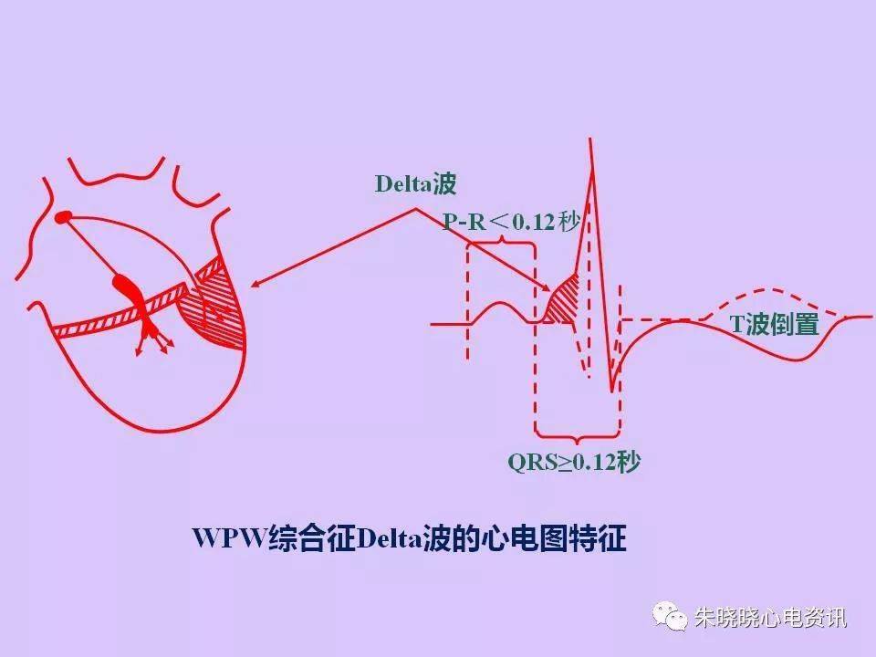 硒产品对肿瘤作用