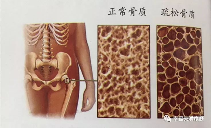 什么钙片补钙效果最好中老年人