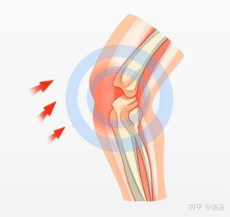 中老年吃什么钙片补钙效果最好