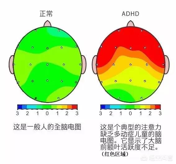 测微量元素