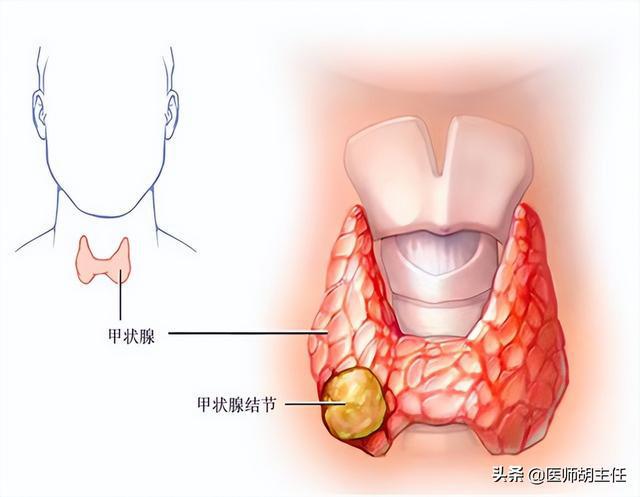 甲亢能吃硒维康吗