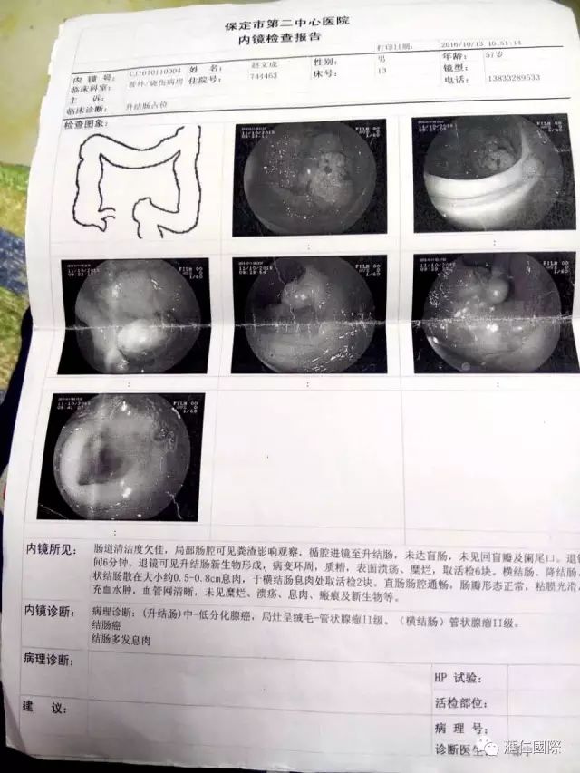 奥希维康是有机硒