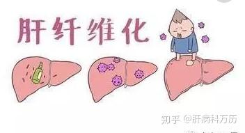 肝纤维化吃硒维康