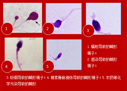 精子畸形吃锌硒宝