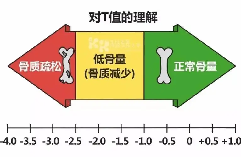 老年人为什么要补钙