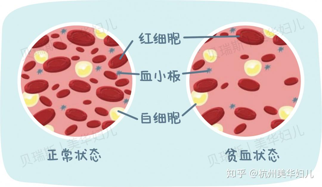 地贫不能补铁