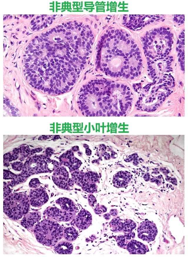 哪一种钙片补钙效果好