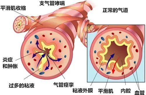 晚期肝癌补硒怎么补