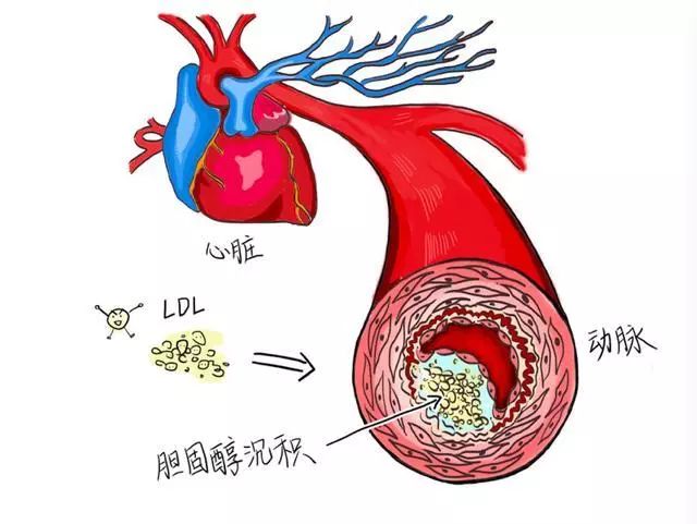 缺硒地区要怎样补硒