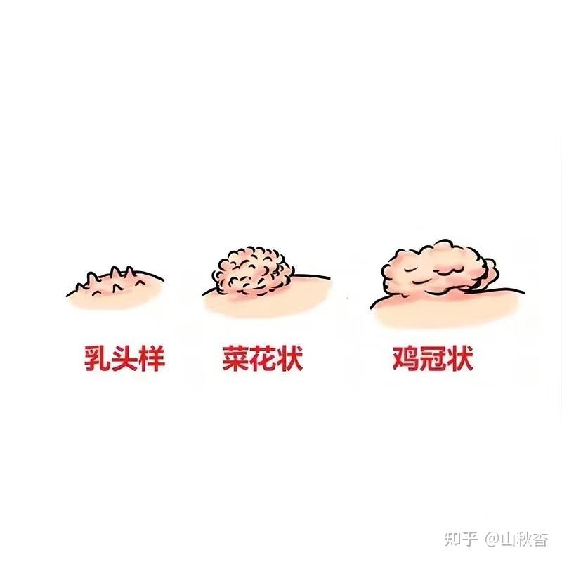 hpv感染补硒推荐