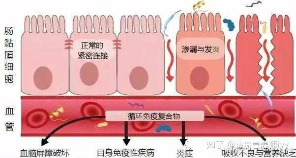 甲状腺结节补海藻硒