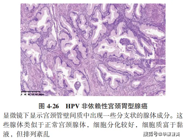 hpv阳性补什么硒