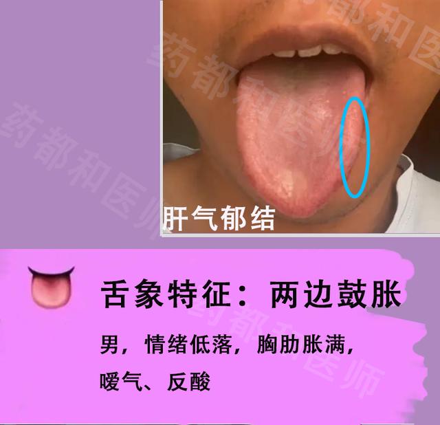 补硒治好了慢性乙肝