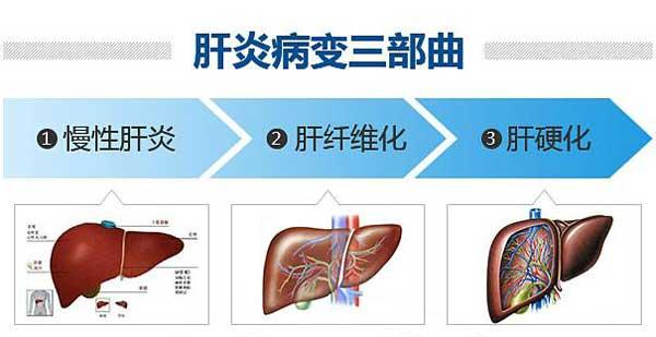 肝肿瘤病人需要补硒