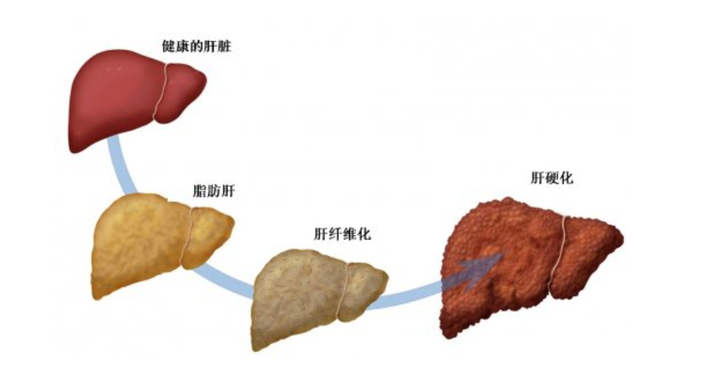 肝硬化患者如何补硒