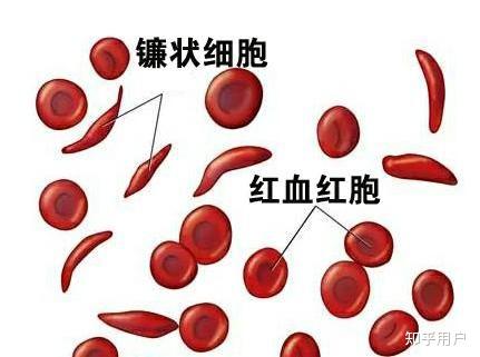 补铁的药一停就立马贫血