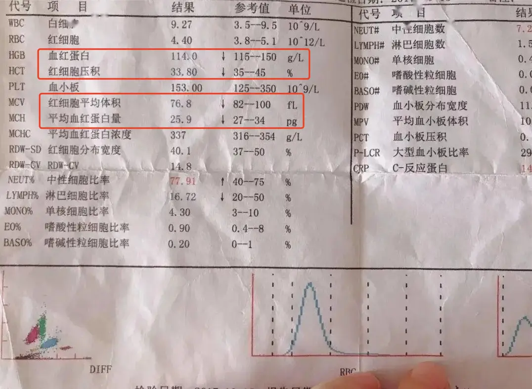 补铁口服液十大排名