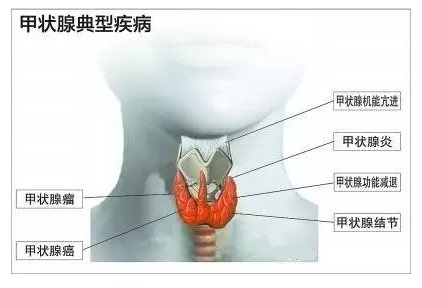 桥本为什么补硒元素