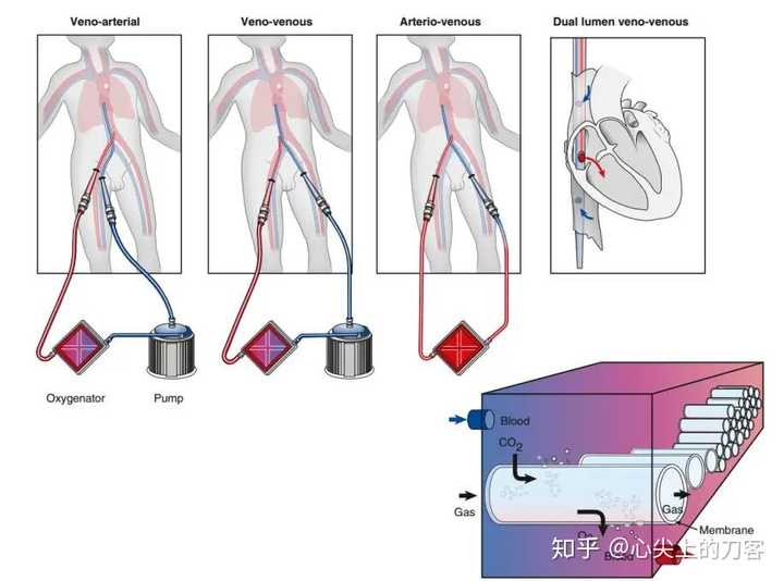 心脏搭桥可以补硒吗