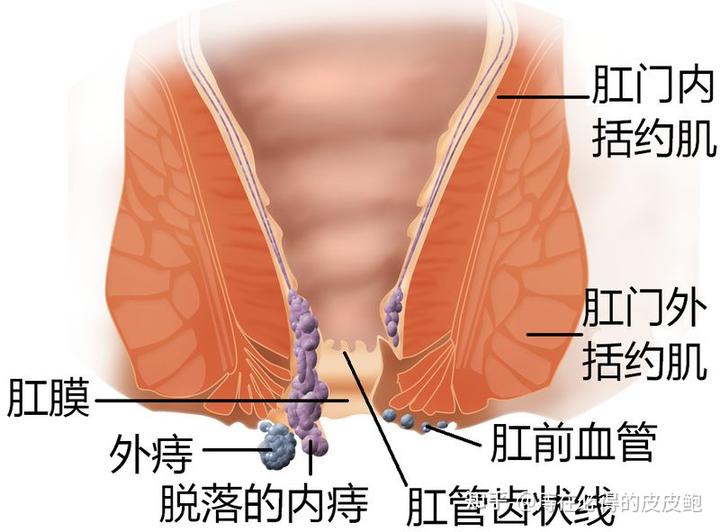 直肠水肿补硒后好了