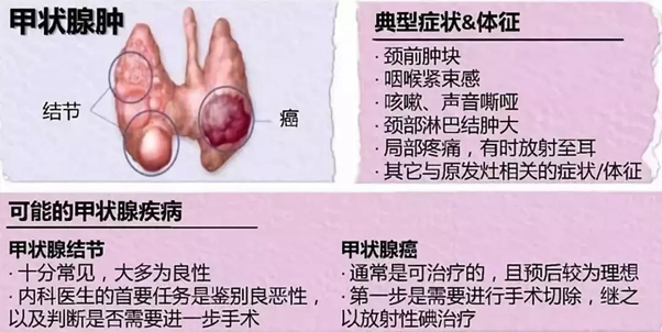 甲状腺结节要补硒吗