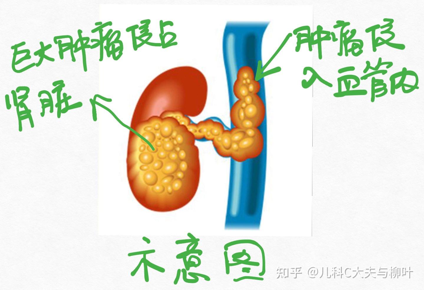 化疗期间补硒吃什么