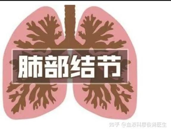 补硒能治疗肺部结节