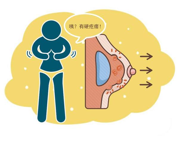 补硒导致乳腺增生吗